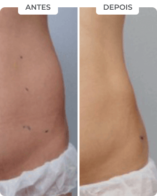 antes-depois-8